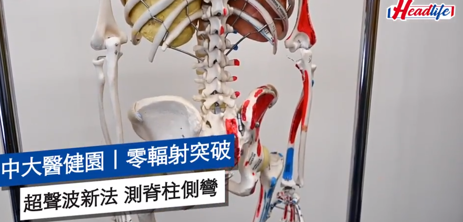 零辐射突破，香港超声波新方法测脊柱侧弯